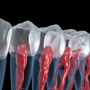 Root Canal Victorville, CA